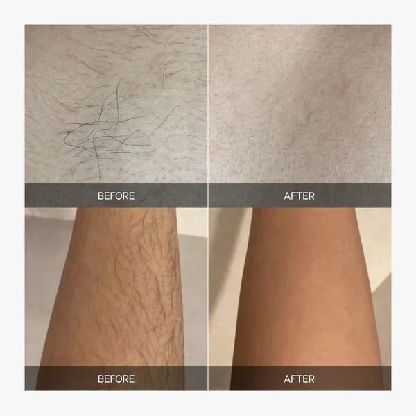 Dispositivo de Depilación en Casa | Mantente suave sin irritación por afeitado – tratamiento corporal completo y suave para piel sensible