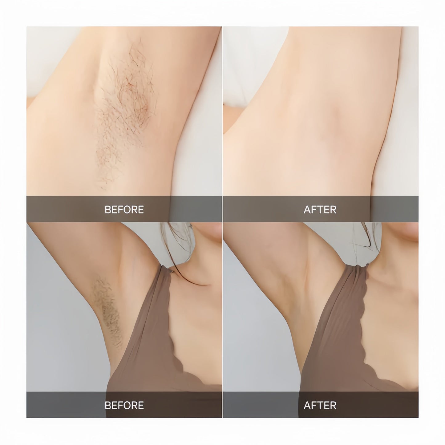 Dispositivo de Depilación en Casa | Mantente suave sin irritación por afeitado – tratamiento corporal completo y suave para piel sensible