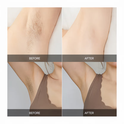 Dispositivo de Depilación en Casa | Mantente suave sin irritación por afeitado – tratamiento corporal completo y suave para piel sensible